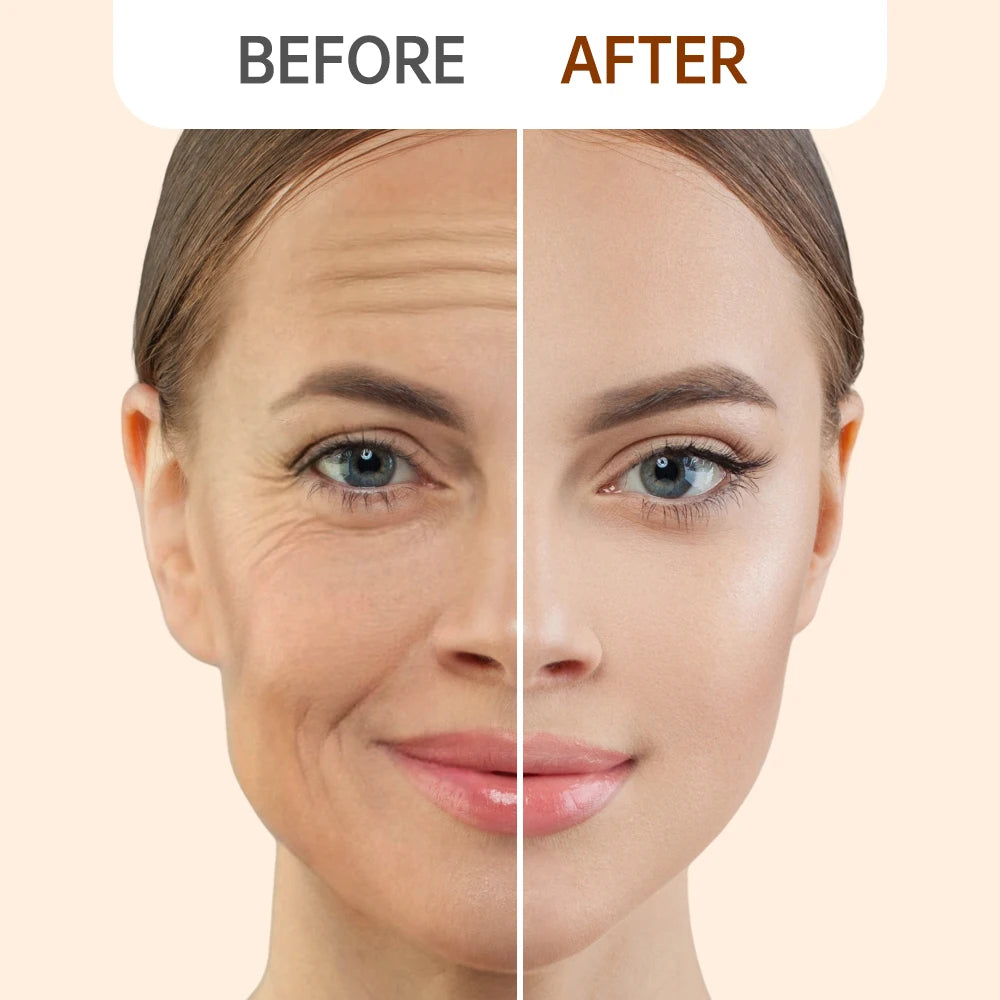 Anti-Wrinkle Retinol Face Cream